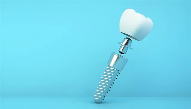 Prosthodontic treatment