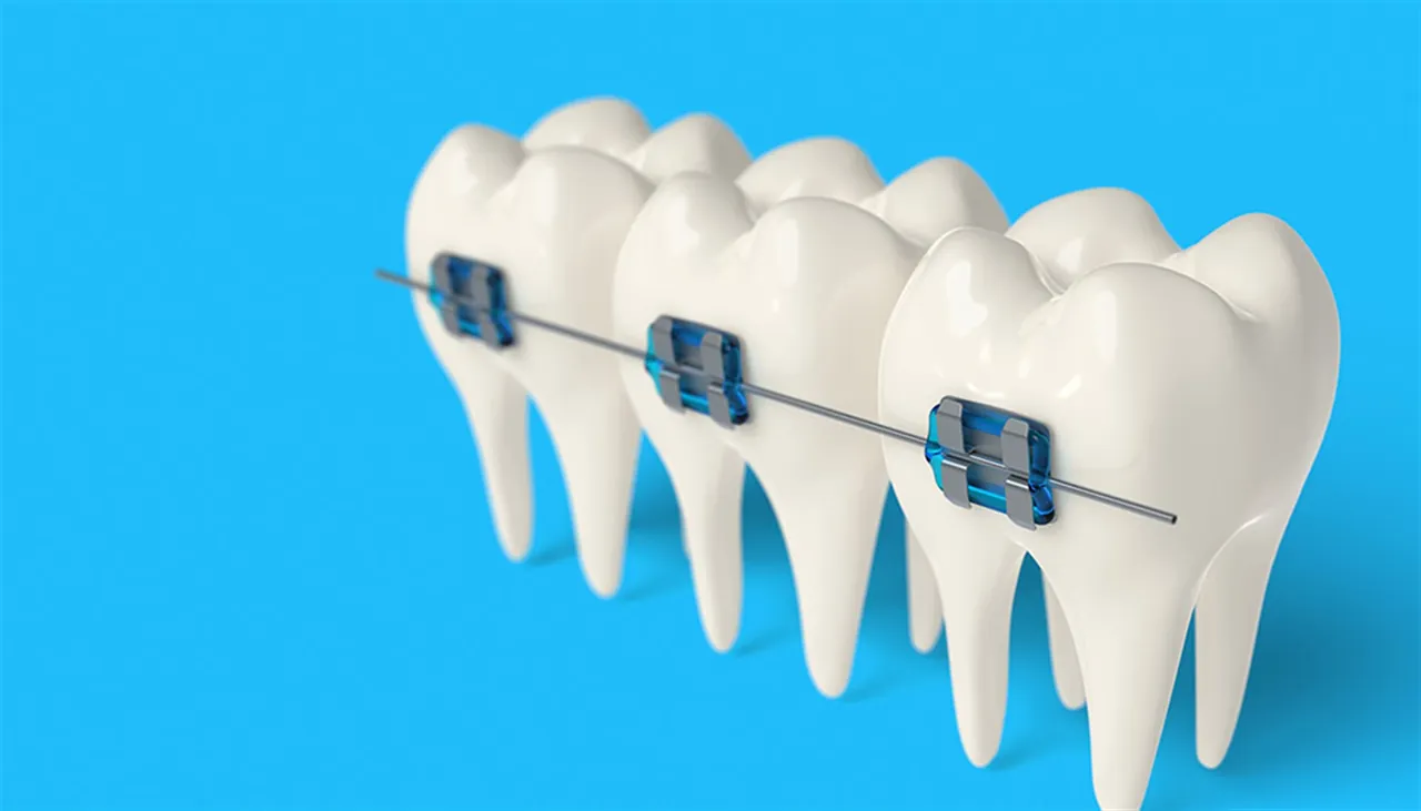 Orthodontic treatment