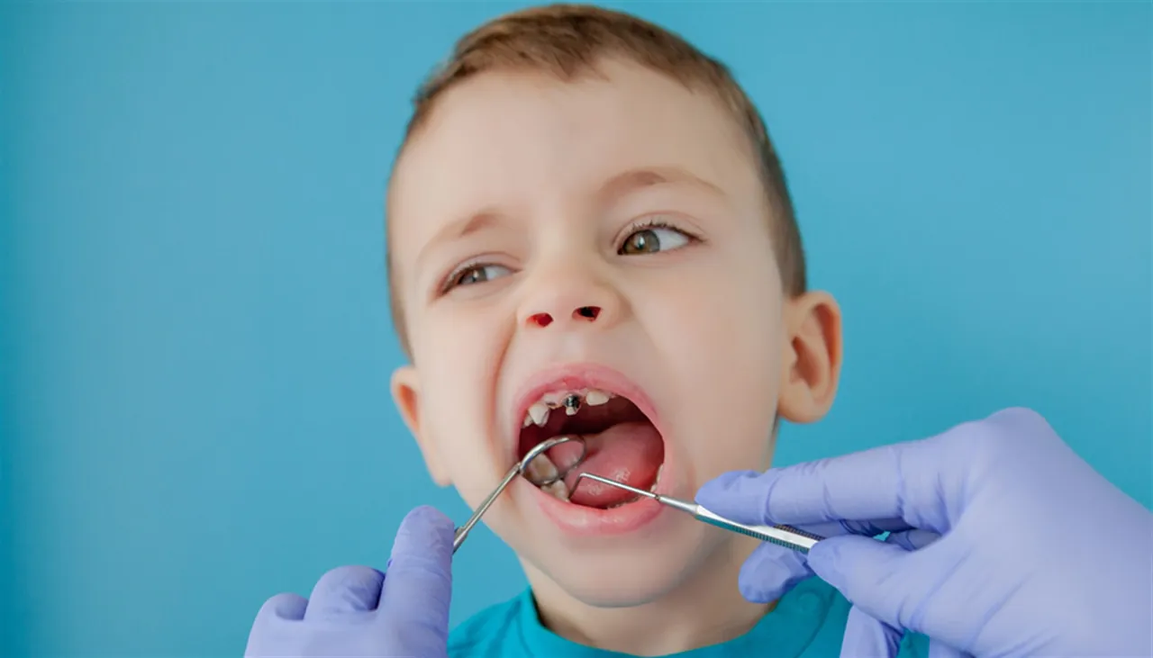 Restorative dental procedure