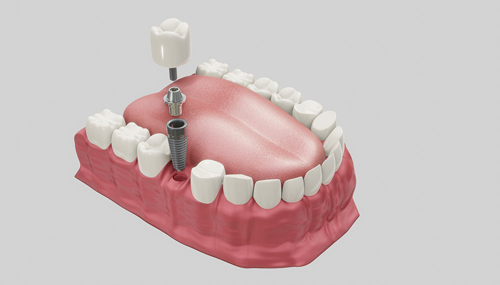 Alejandro Quesada - Clínica Dental San Rafael